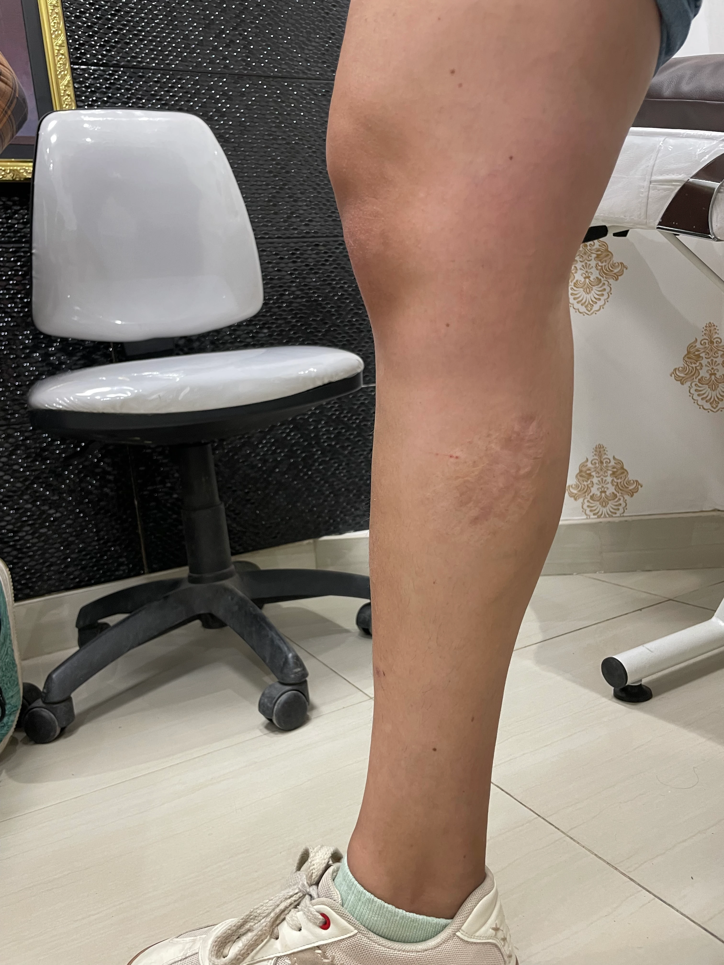 Cobertura de tatuaje cover up en Huancayo